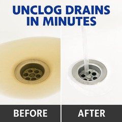 Manual Drain Snake & Auger Tool &ndash; Metal Cable Clog Remover for Sinks, Showers&hellip;